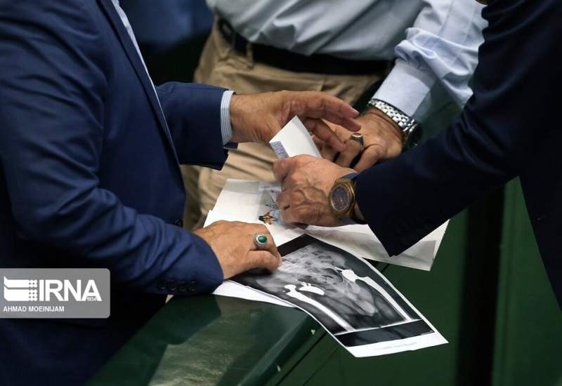 عکس | ساعت یک میلیاردی در دست نماینده مجلس